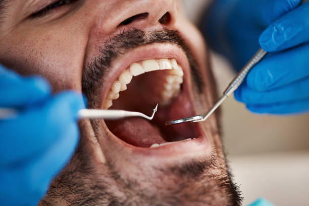 Best Emergency Broken Tooth Repair in Pine Grove, PA